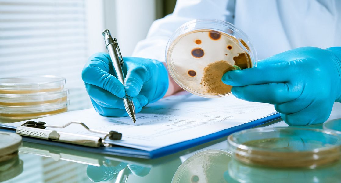 Top 10 Challenges in Bioburden Testing and How to Overcome Them